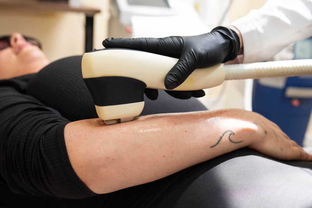 How Many Laser Hair Removal Sessions Are Needed for Long-Lasting Smooth Skin?