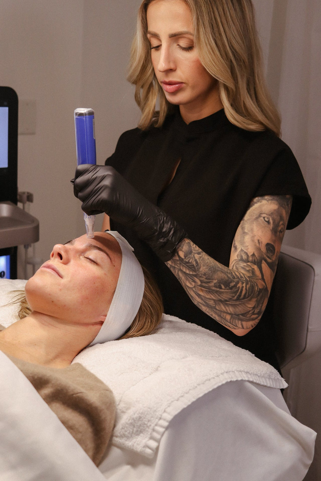 Microneedling in Chilliwack: Benefits, Results, and What to Expect