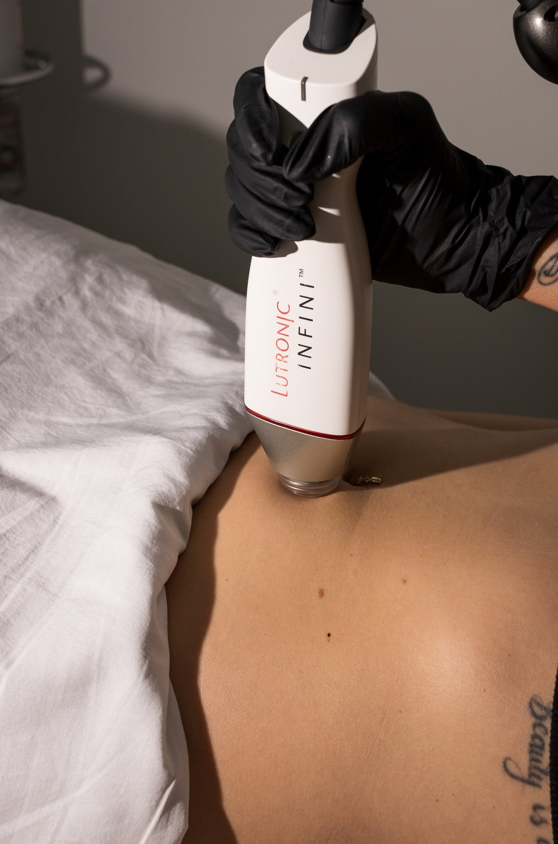 RF Microneedling in Chilliwack: Tightening, Acne Scars, and Skin Remodeling