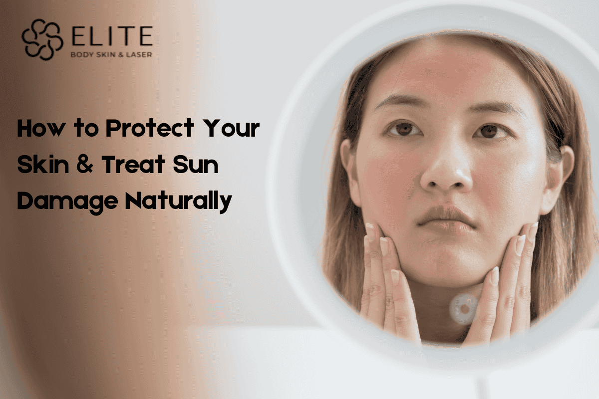How to Prevent and Treat Sun Damage Effectively