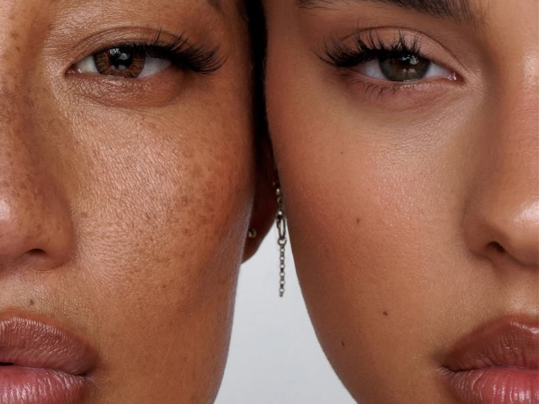 Non-Ablative vs Ablative Laser Resurfacing: Which One Do You Actually Need?