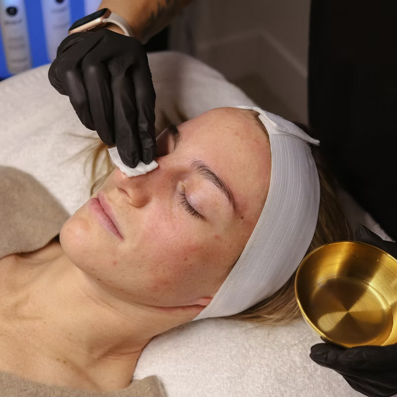 Calm + Clear Treatment Program