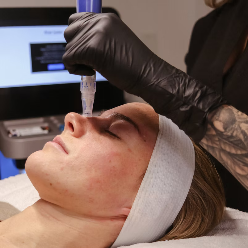 SkinPen + HydraFacial Combo Treatment