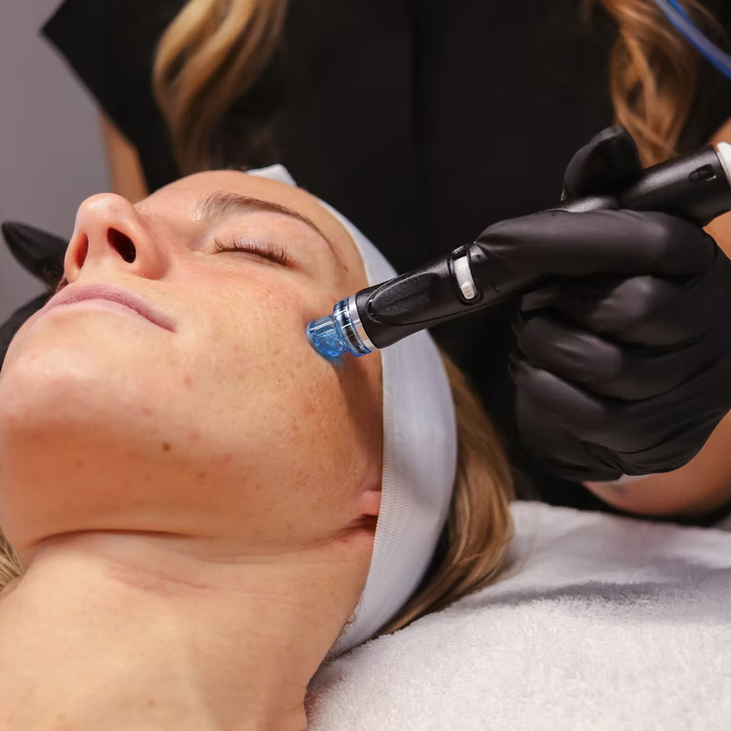 Aerolase + HydraFacial