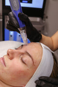 Tier 4 Aerolase Full Face or Microneedling Full Face + Light Peel