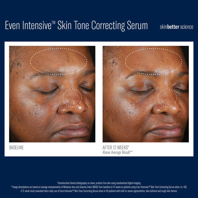 Skinbetter Even Intensive Skin Tone Correcting Serum